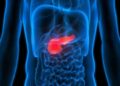 A Promising AI Pancreatic Cancer Detection Model Could Save Lives in Clinical Practice Soon