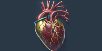 Public Health Needs Better AI Data for Cardiovascular Disease Treatment